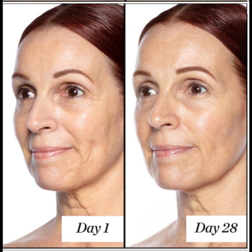 Sunday Riley Good Genes lactic acid treatment - Picture 4 of 6